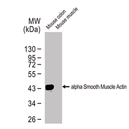 alpha Smooth Muscle Actin antibody [HL1419]